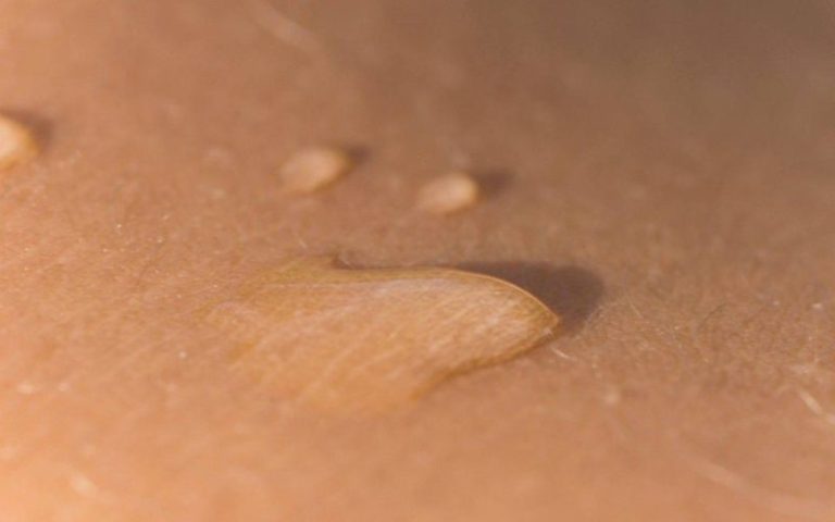 Pelle eruzioni cutanee