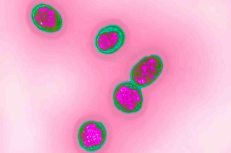 Batterio Brucellosi Cina