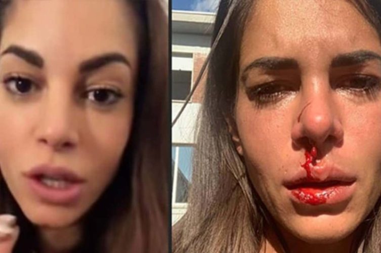 Giada Giovannelli picchiata